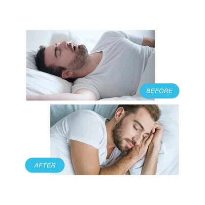 PureBreathe™ Nasal Breathing Kit